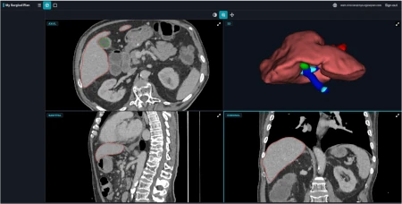 3D model in an imaging viewer